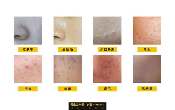 护肤保养知识_26岁干性皮肤女人如何保养护肤_护肤保养图片对比反馈图