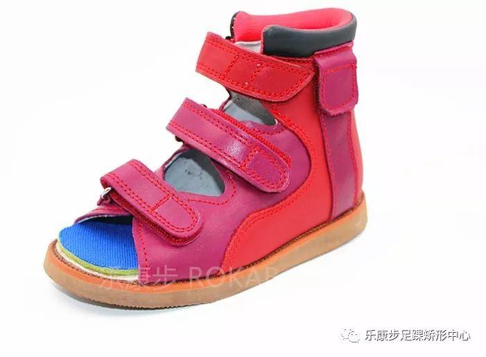 尖足矫正临床效果分析