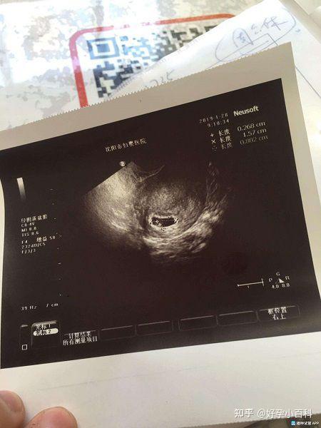 胎心胎芽图图片