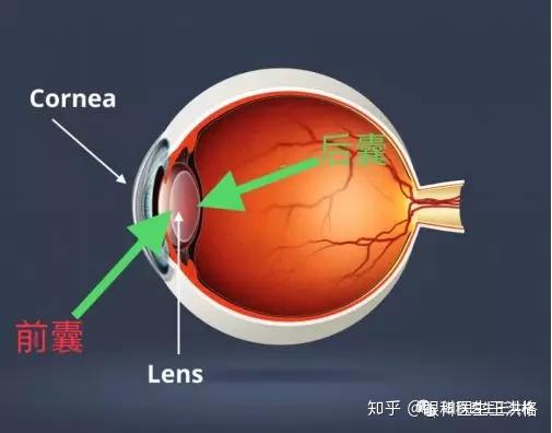 人的晶状体外面包着一层膜状结构,即晶状体的囊袋.