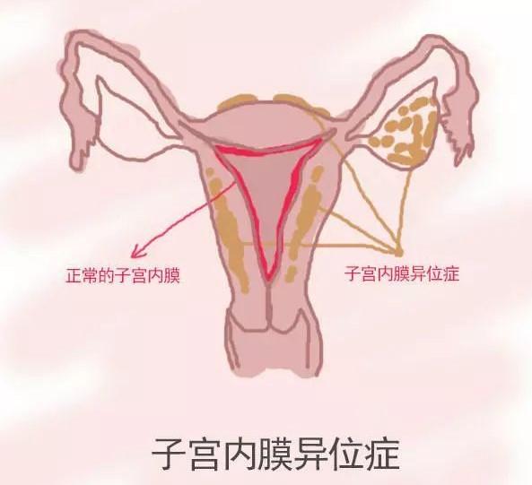 v2-5a3b182b6ef1fa7f15bae7ca1a8157c4_1440w.jpg?source=172ae18b
