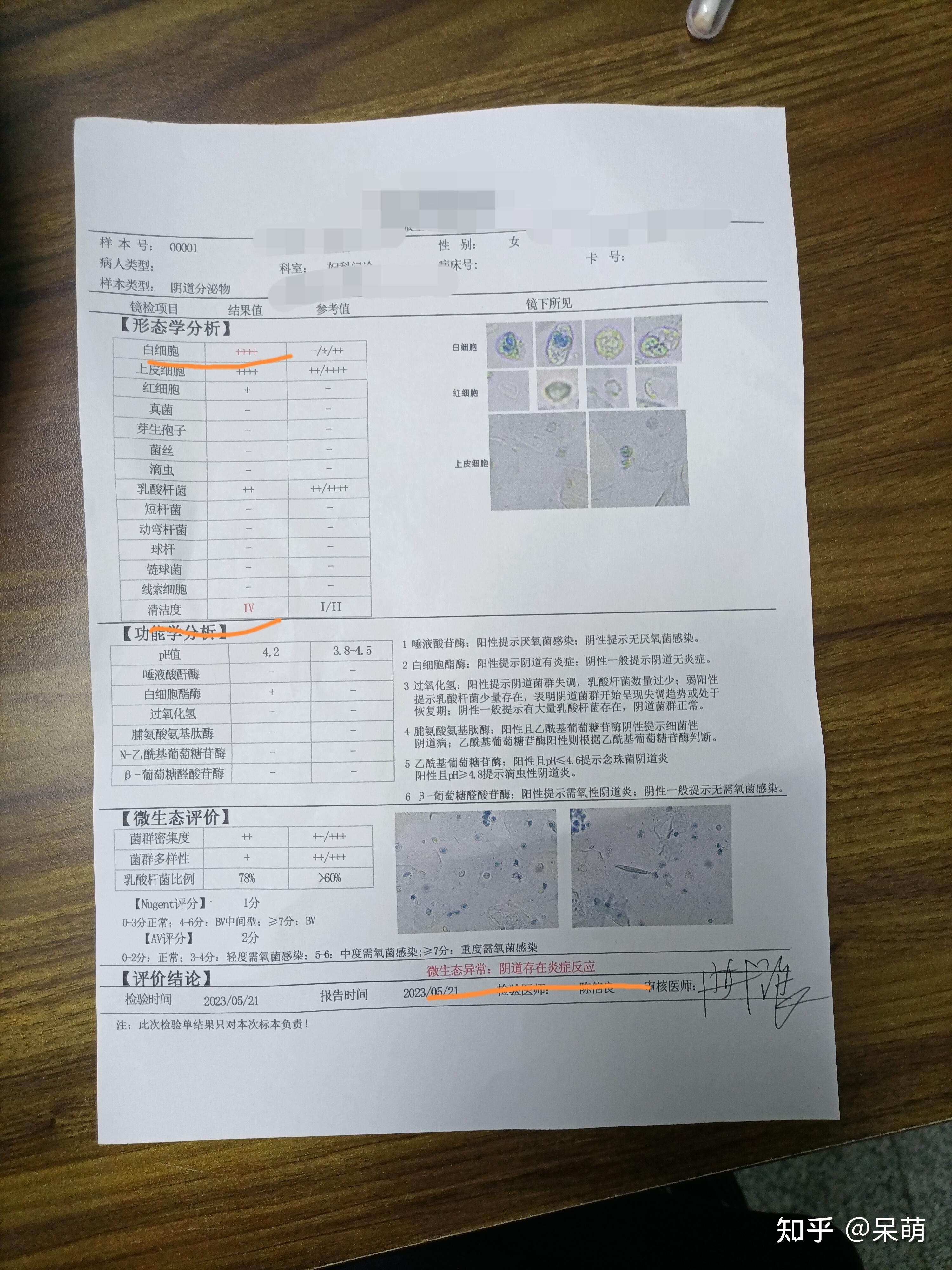 痰培养结果图片