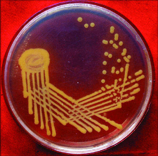 平板划线法大肠杆菌图片
