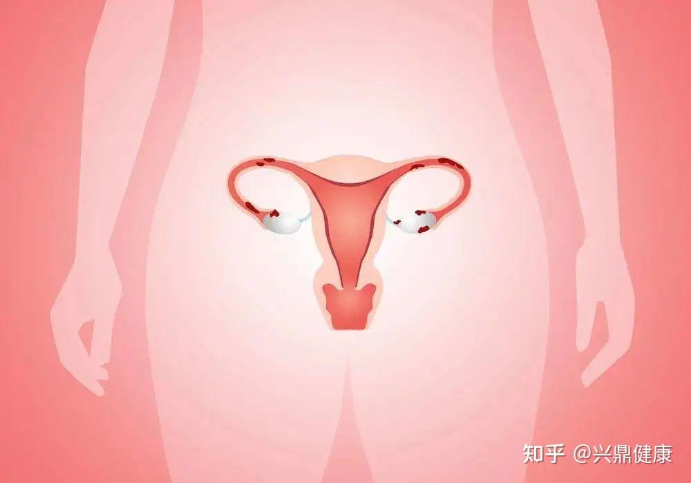 子宫微生物群与女性不孕不育的相关性