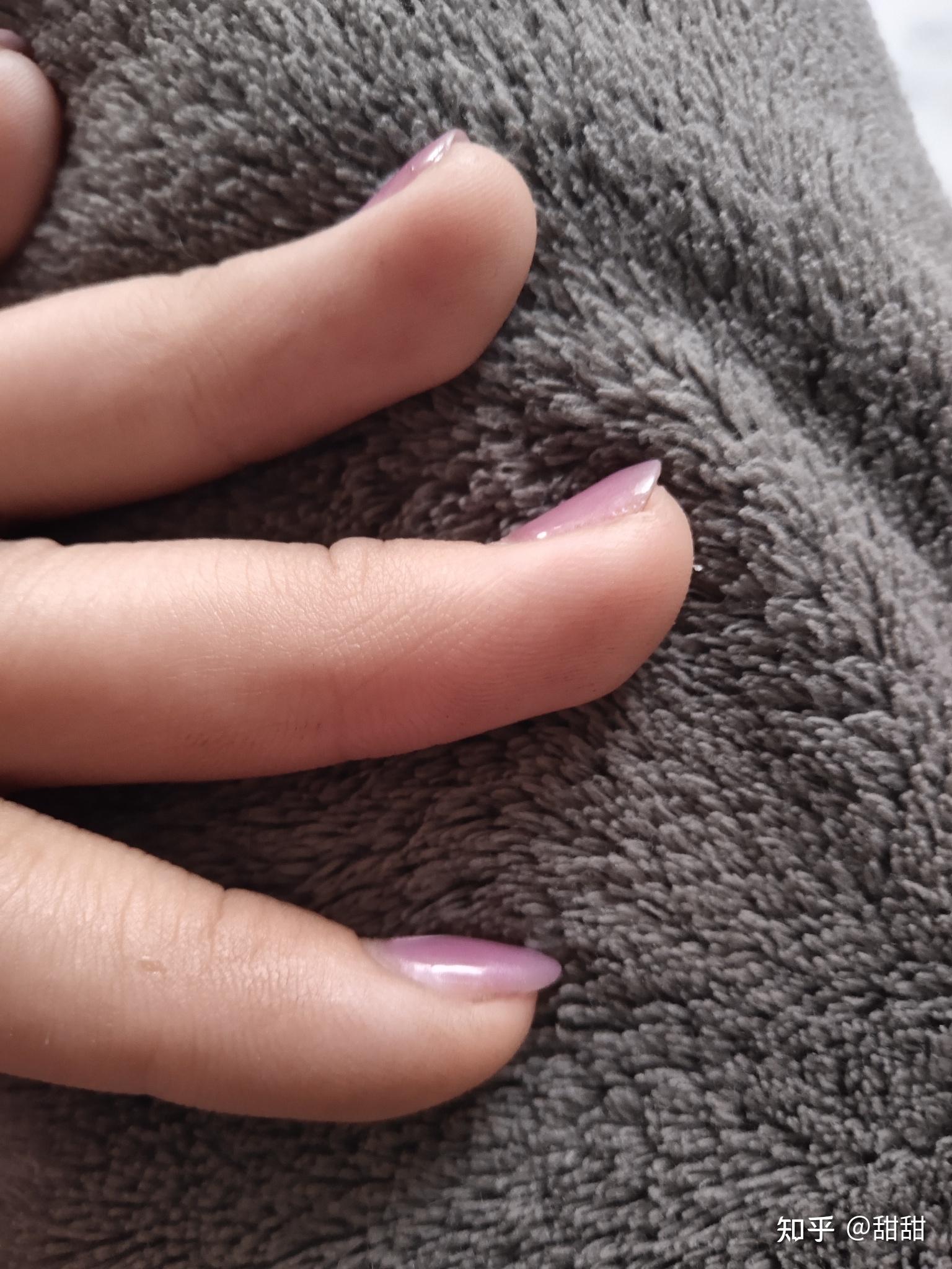 指甲向上翘? - 知乎