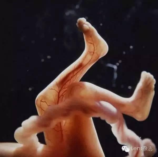 著名摄影师拍下精子进入卵子的瞬间