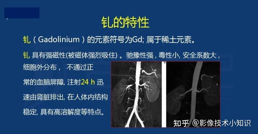 MRI对比剂 - 知乎