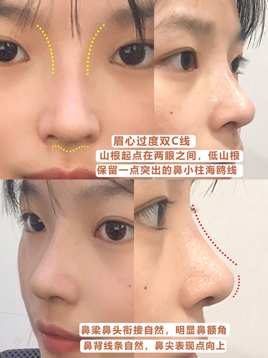 鼻型审美功课 知乎 鼻型审美功课 知乎