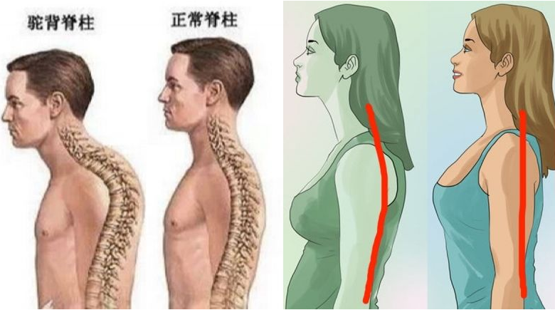 这时你的脊柱是打直的,身体立身中正安舒,如果练正常站直站立都站不好