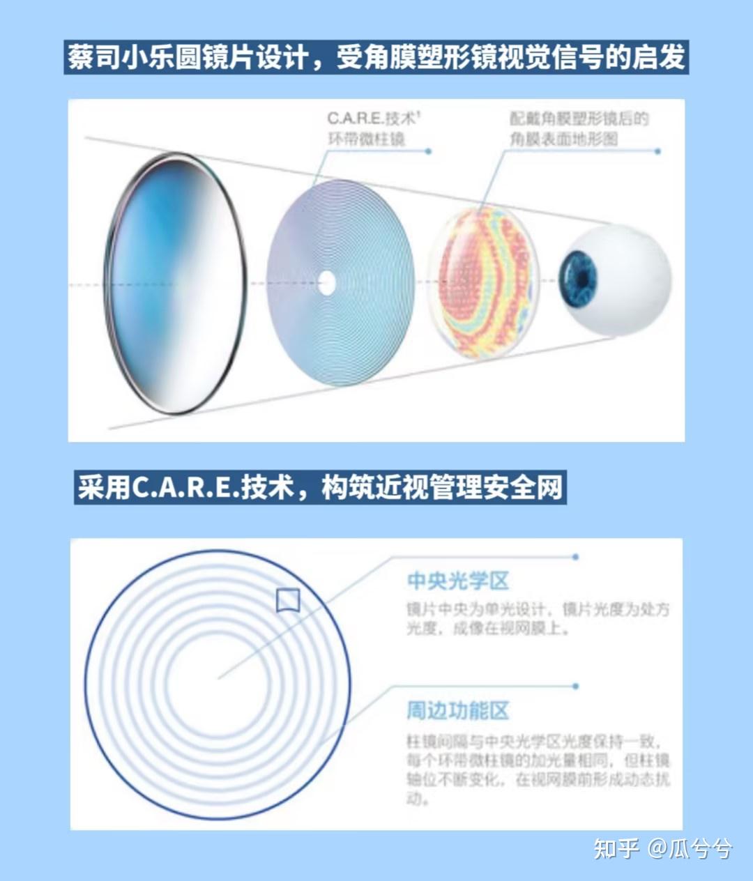 e同心环带微柱镜技术蔡司小乐圆镜片
