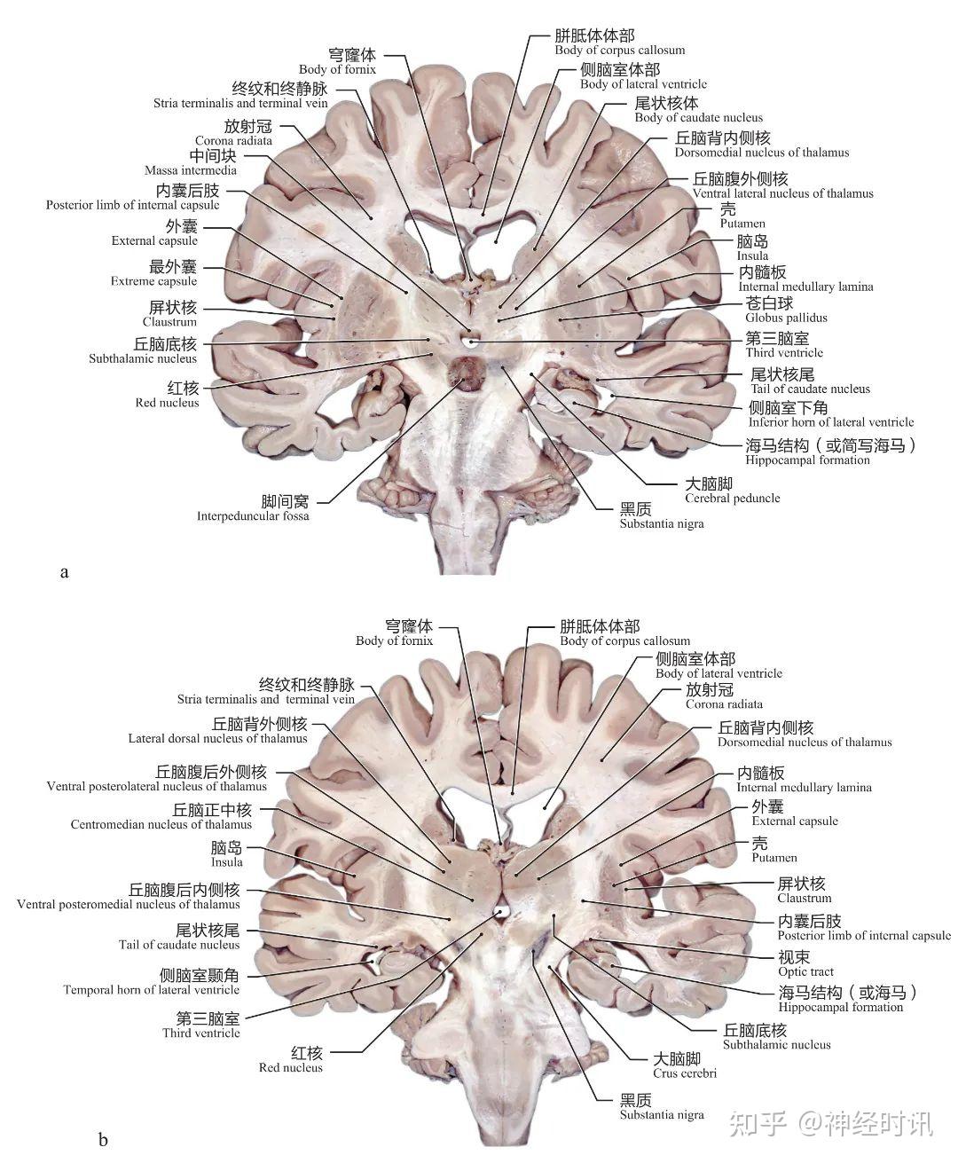 脑干的内部解剖、表面解剖(内附详细标注解剖图) - 知乎