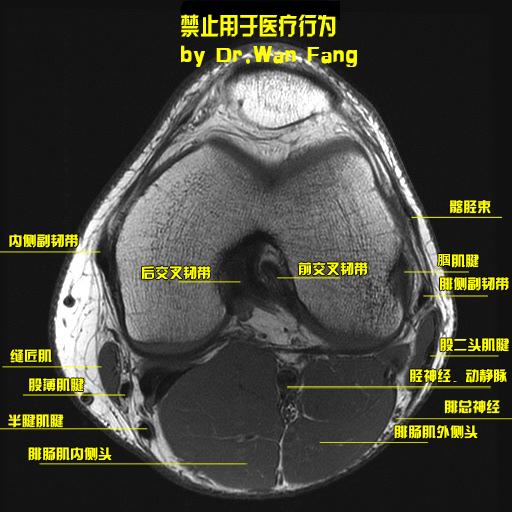 自制史上最详细膝关节磁共振应用解剖图谱