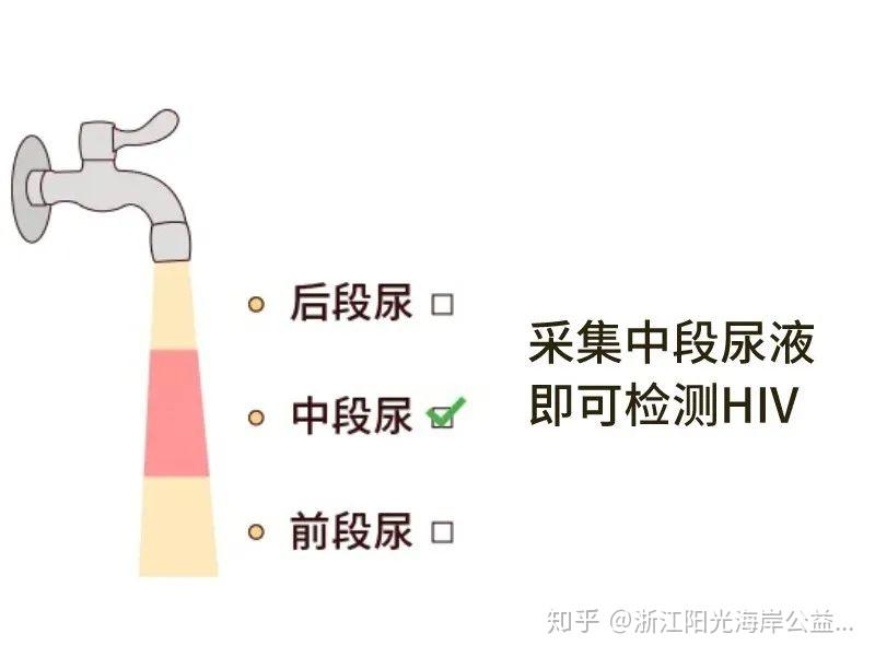 国产首个hiv尿检试纸