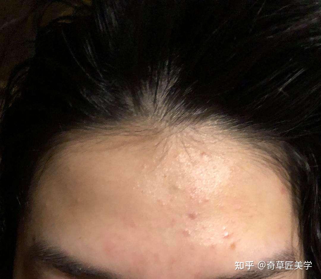 什么是闭口 - 知乎