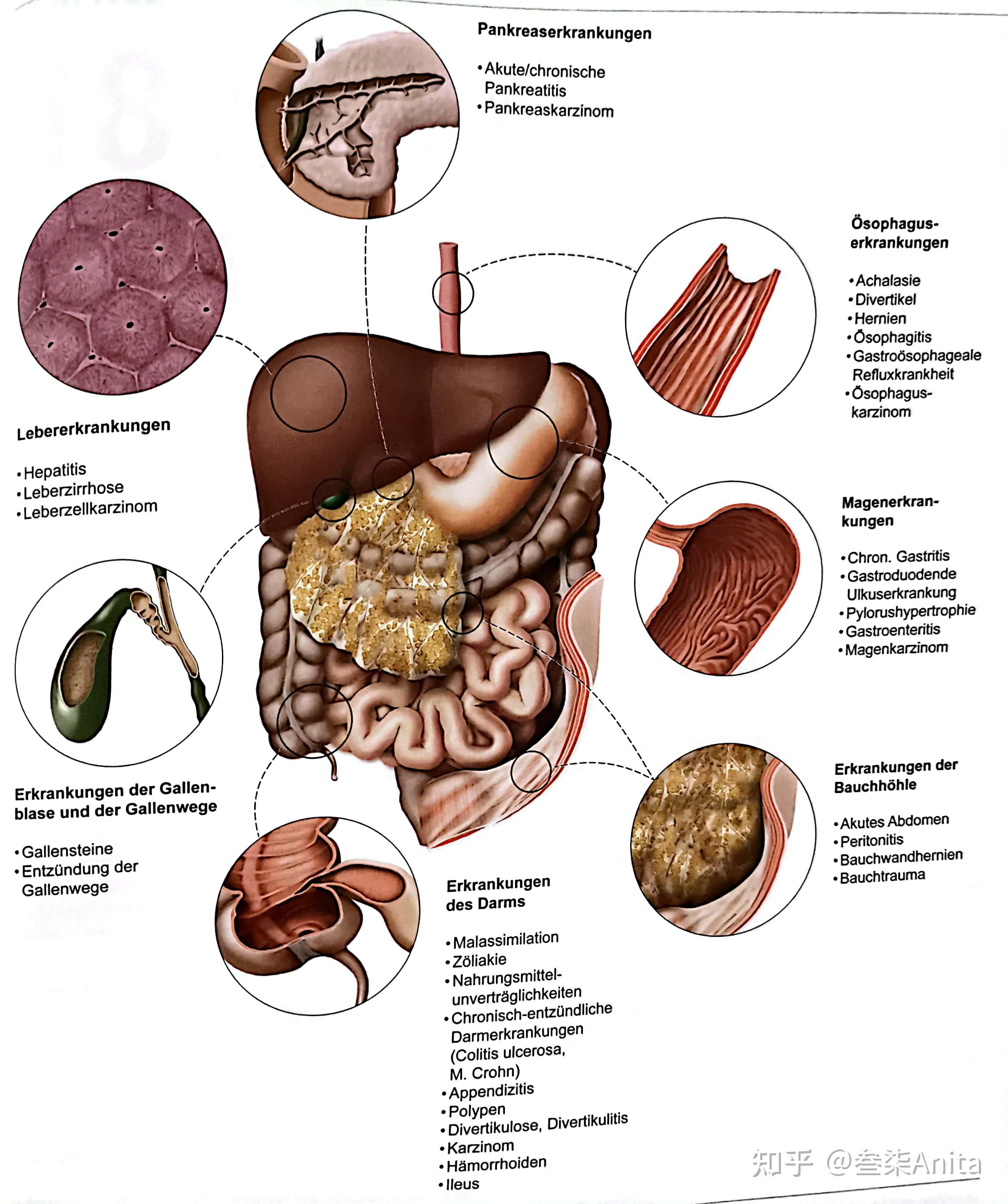 腹部創傷)腸道疾病(器質性:腸道炎症,急慢性闌尾炎,腸痙攣,腸梗阻