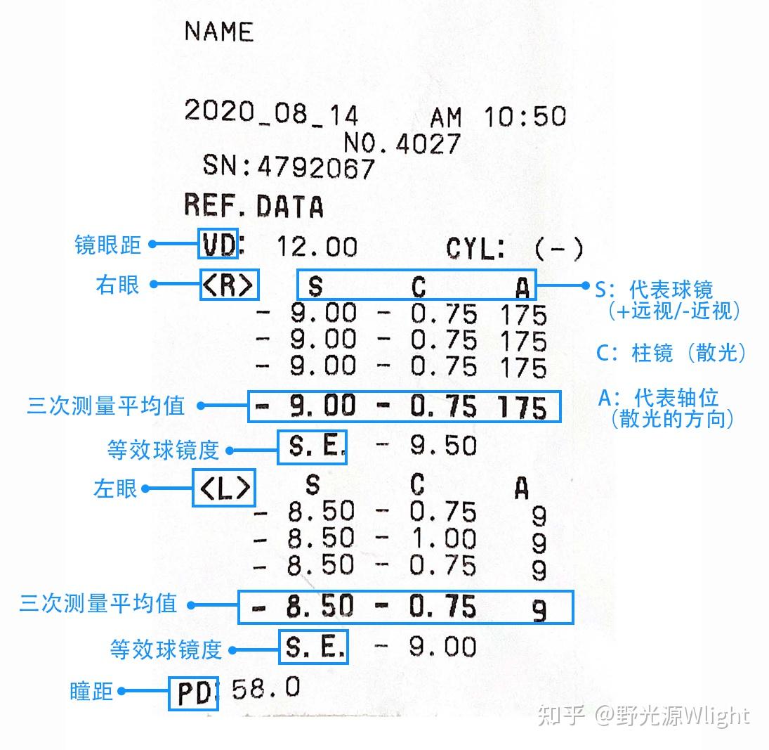 裸眼视力va 不戴镜时测量的视力球面sph 表示近视或远视度数