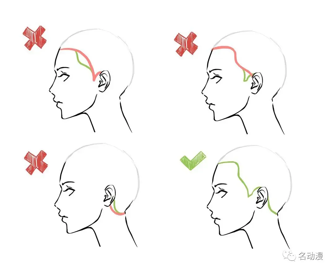 误区7:随意确定发际线