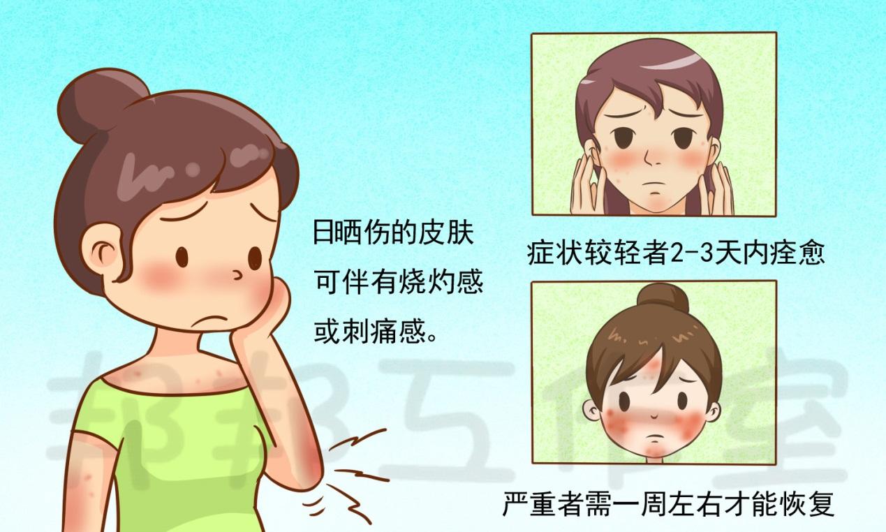 晒伤后怎么办? - 知乎