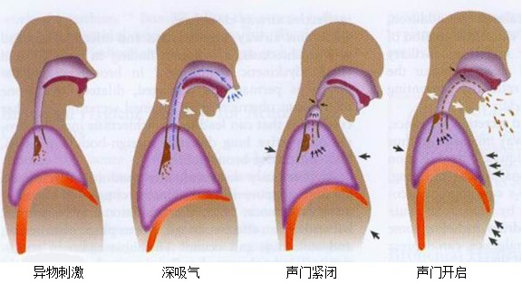 人体出痰别急着吃药搞清痰的性质很重要