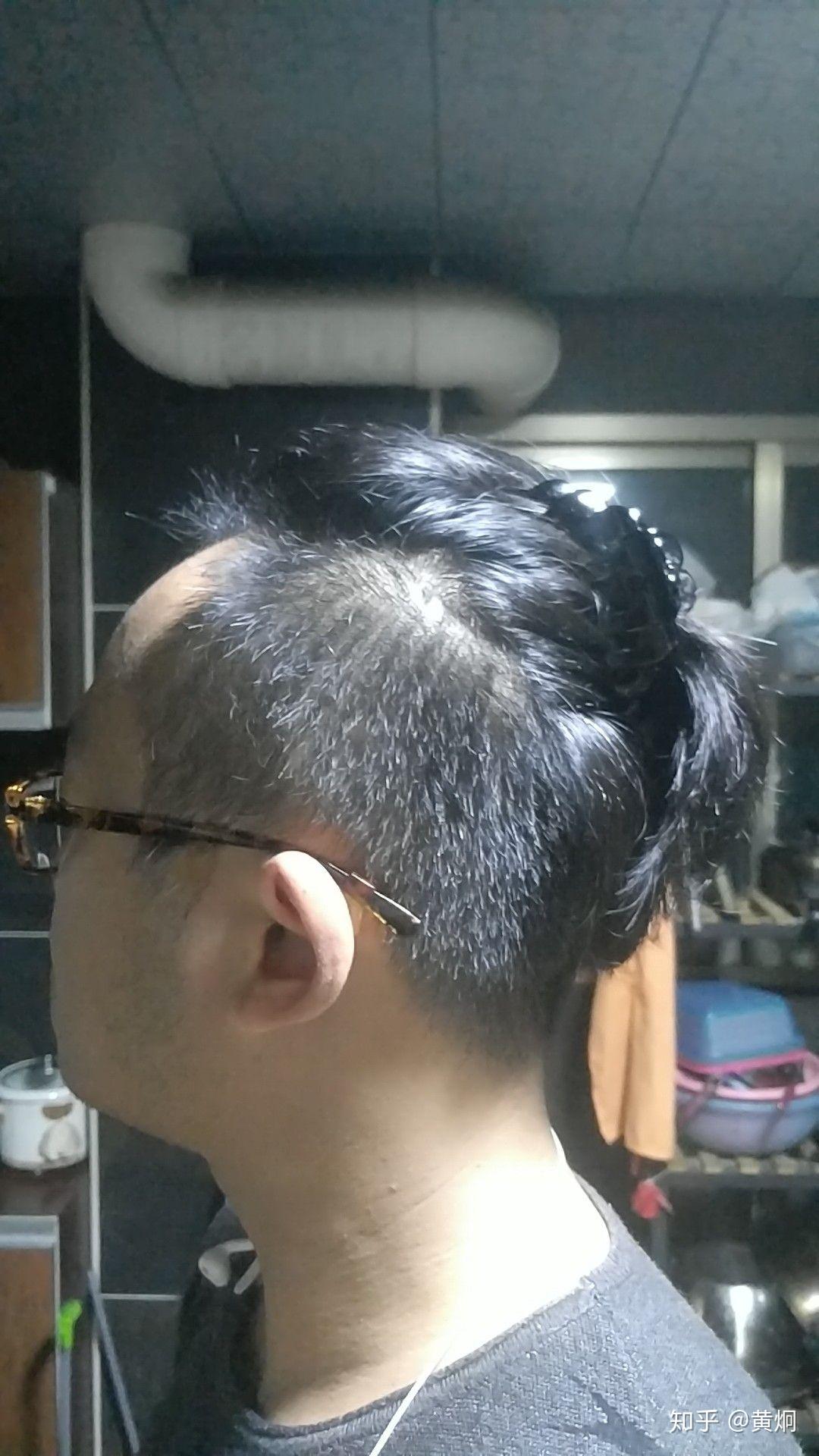 男人“M字”发际线别乱剪发型，注意3个技巧，轻松打造帅气发型 - 知乎
