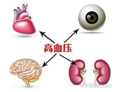 原发性高血压发病原因是为什么在线