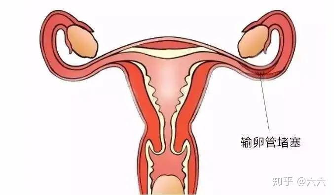 探索兰州不孕不育治疗新方向