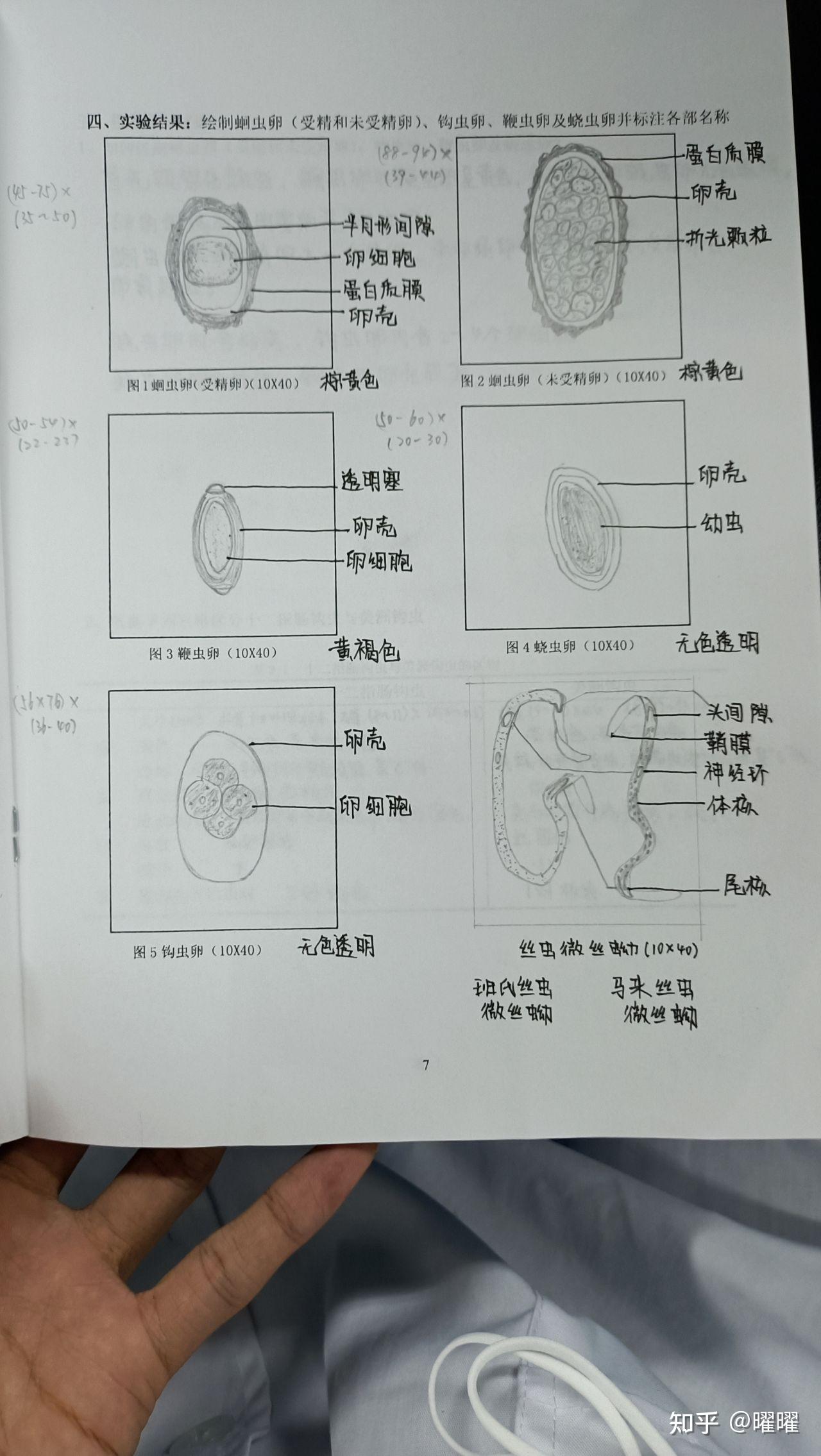 结肠阿米巴包囊结构图片
