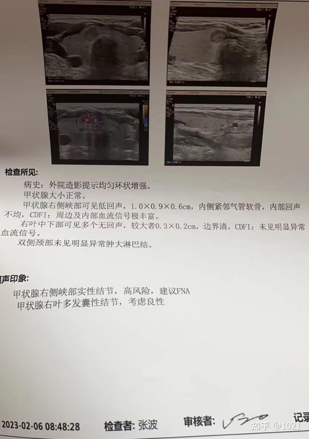 中日友好甲状腺b超终于做上了! - 知乎