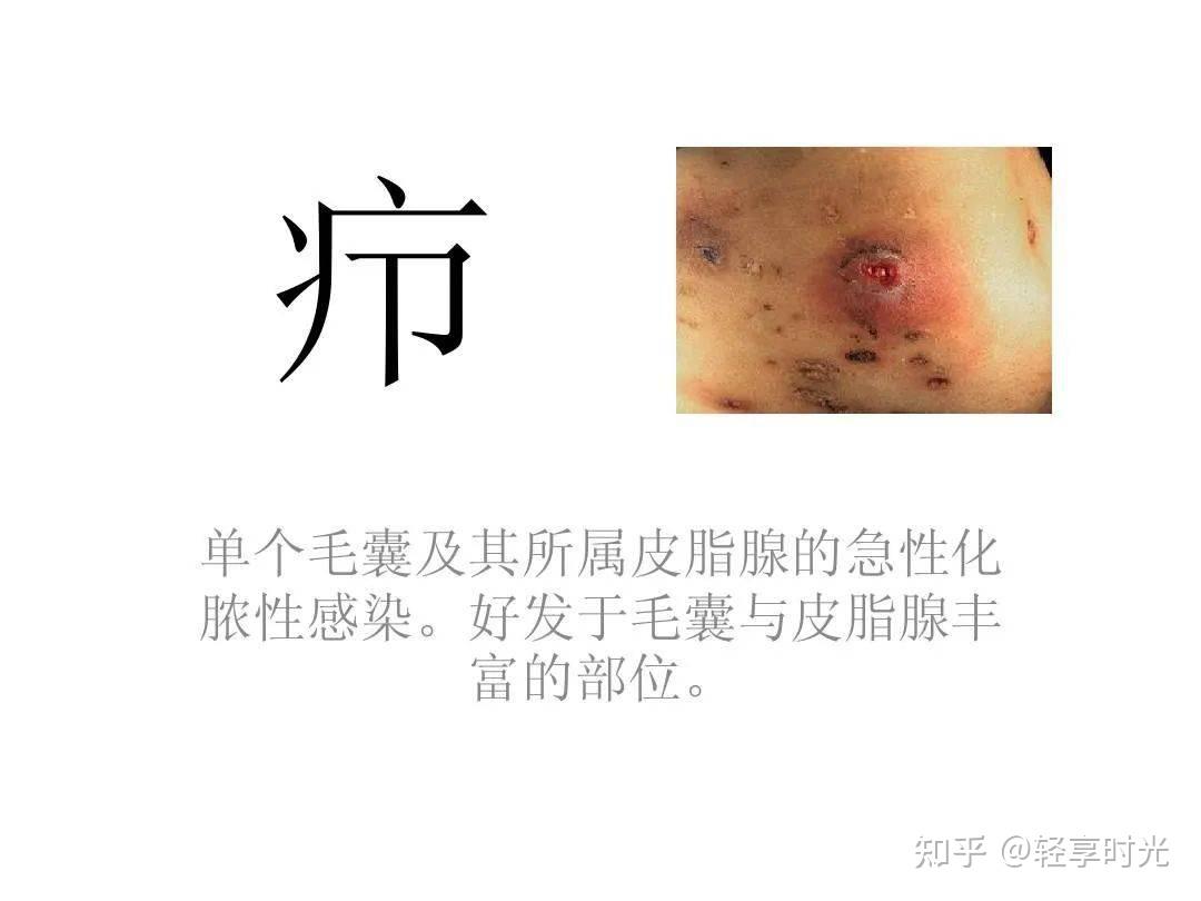 疖的食疗方法及疖疔疤肿食疗美容原则 - 知乎