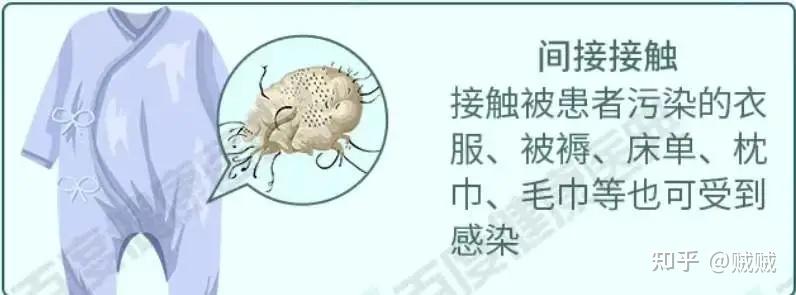 预防疥疮小知识 - 知乎