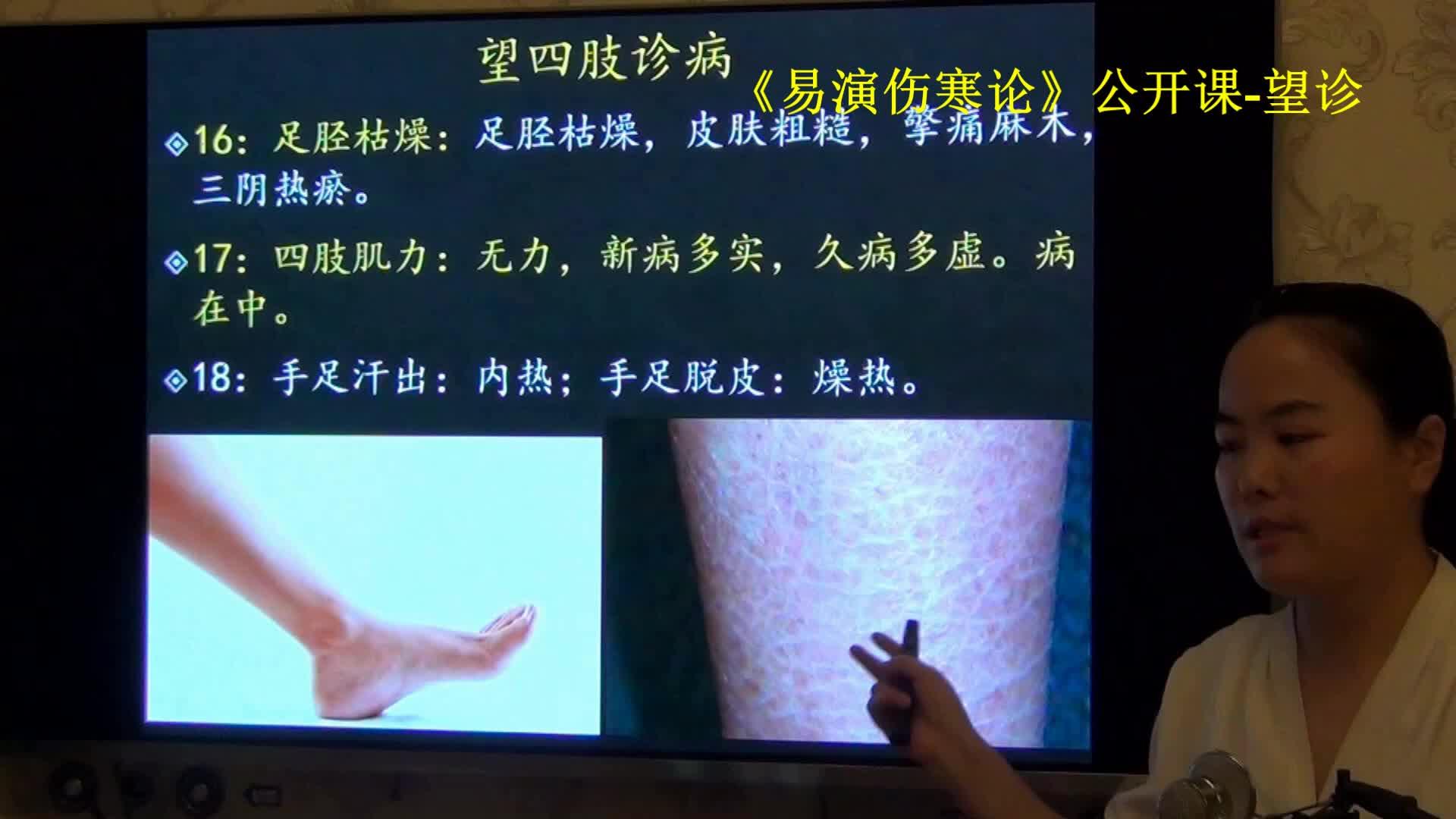 194中医望诊撮空引线循衣摸床-易演伤寒论