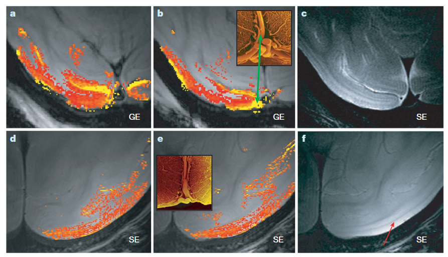 5-17：What we can do and what we cannot do with fMRI - 知乎