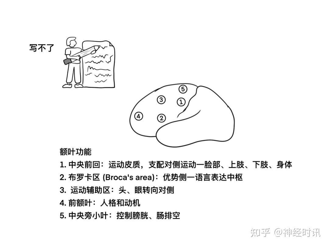 脑皮层的分叶、额叶及顶叶的结构、功能及受损表现【全了】 - 知乎