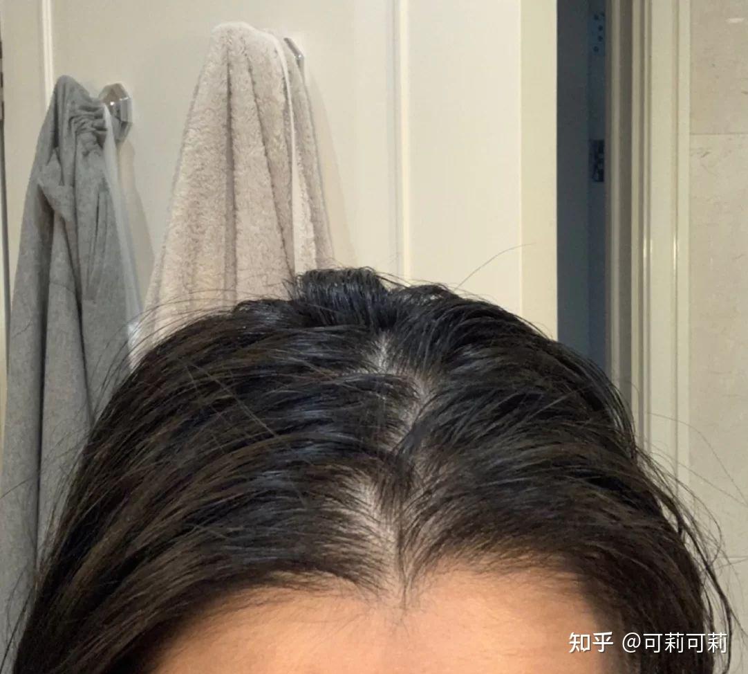 为什么有的人发量多,有的人发量少?选好洗发水是关键!(内附育发液推荐和护发心得) - 知乎
