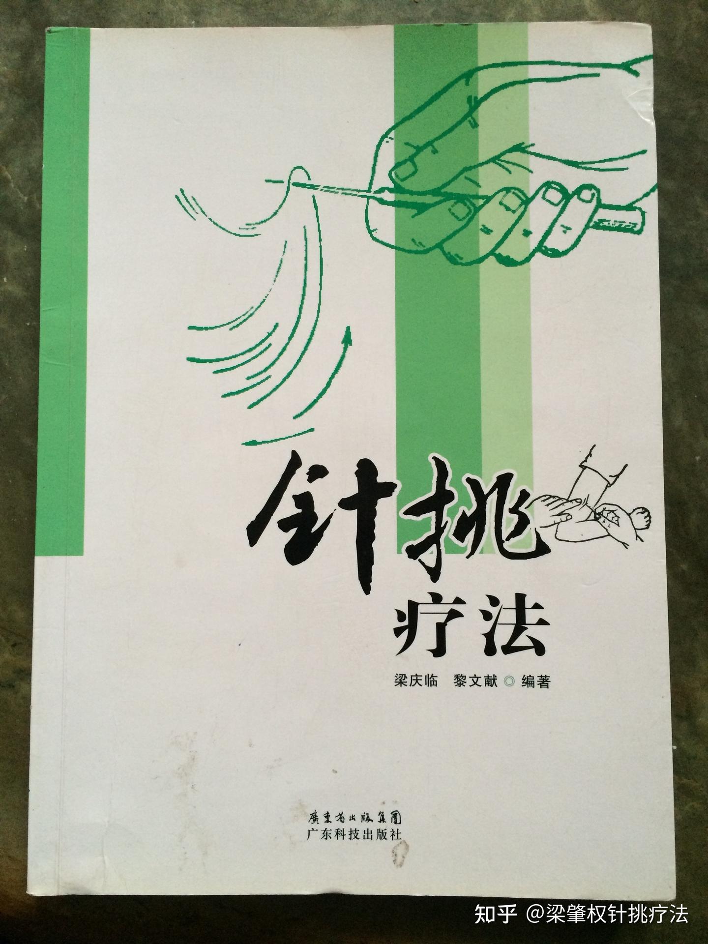 关于针挑疗法故事之二一一我学针挑背后的曲折故事 梁庆临 - 知乎