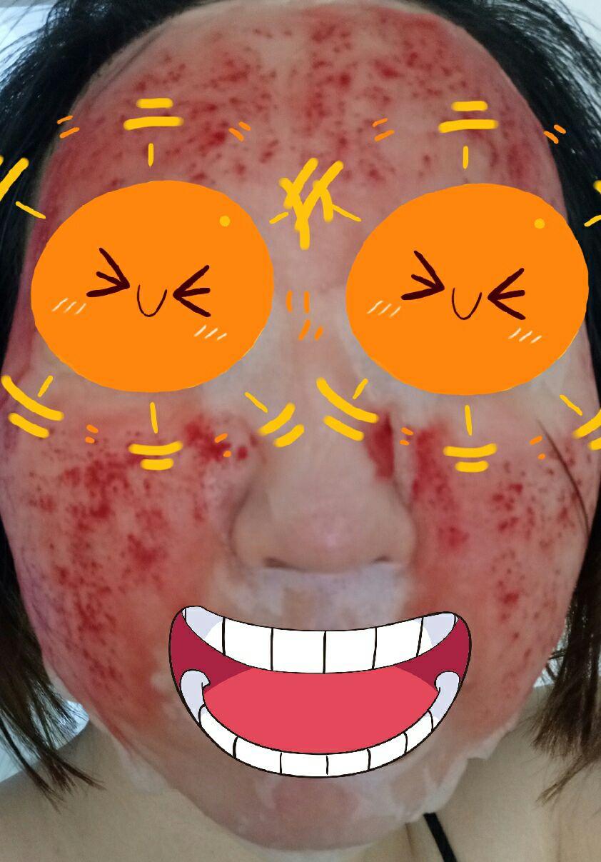 如何去除脸上的痘印、痘坑?