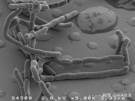 肠道核心菌属普拉梭菌faecalibacteriumprausnitzii预防炎症的下一代