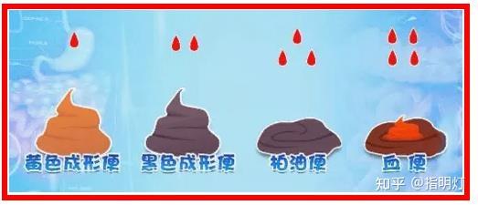 谈一谈什么是大便隐血(潜血)? - 知乎