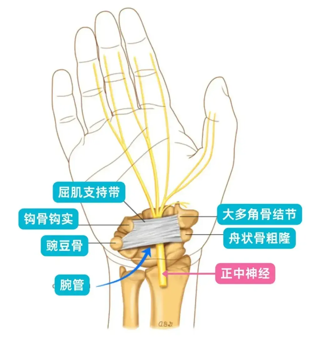 从入院到死亡,仅四天!医生提醒:经常手麻,或是8种疾病征兆 - 知乎