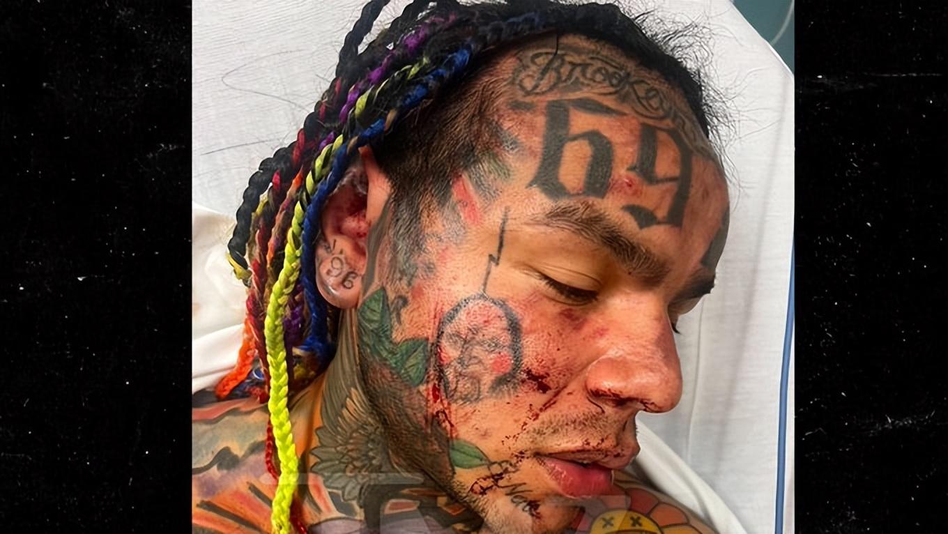 太惨!说唱歌手6ix9ine被多人围殴,送往医院抢救!网友居然纷纷叫好!