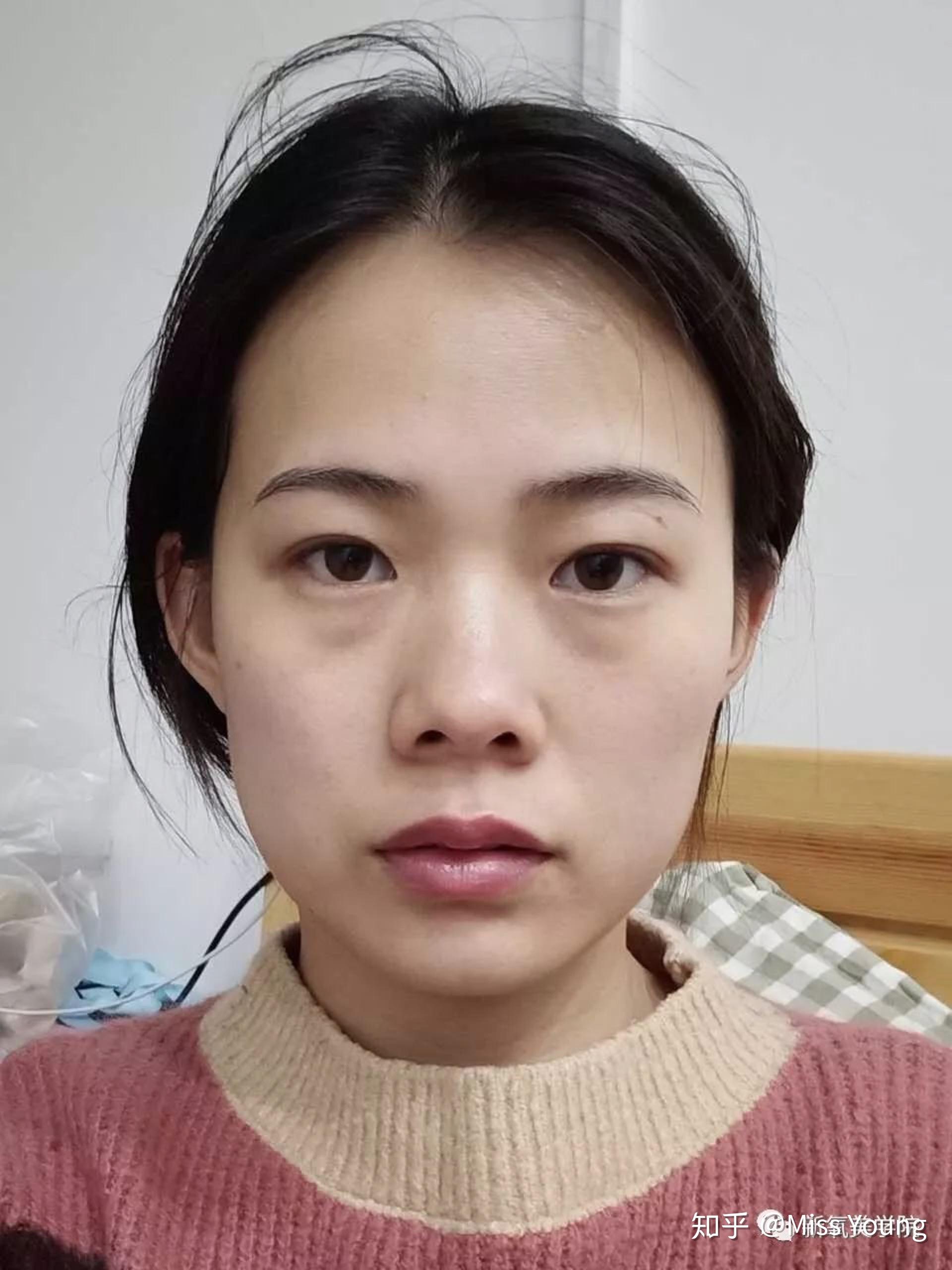 迷死氧看脸爆改侧面嘴凸女孩变身天仙侧颜杀