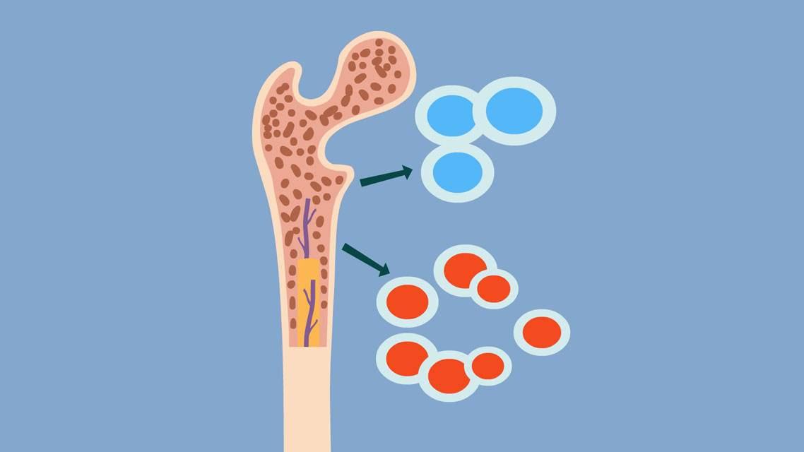 mds患者不想骨髓移植靠化疗来维持治疗可以吗