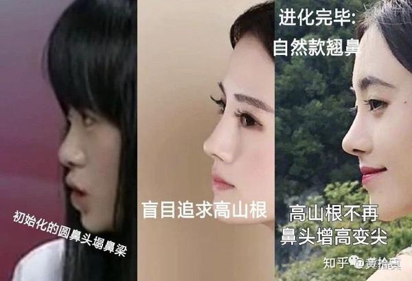 隆鼻术后通天鼻阿凡达 盘点山根的重要性 知乎 隆鼻术后通天鼻阿凡达 盘点山根的重要性 知乎