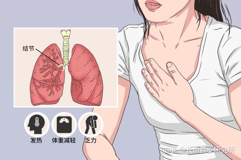 肺结节良恶性筛查丨打破单一ct影像诊断 七种肺癌相关抗体检测测评