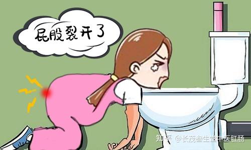 你体验过菊花裂开的痛苦吗? - 知乎