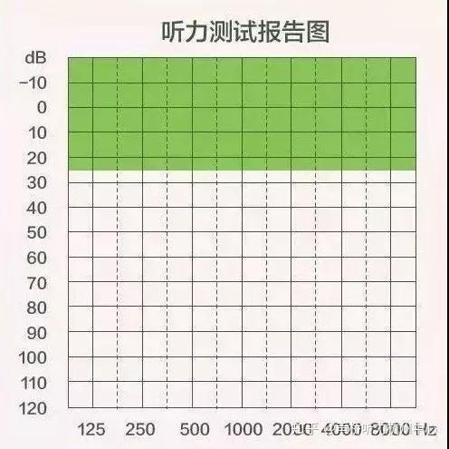如何看懂纯音测听报告？ - 知乎