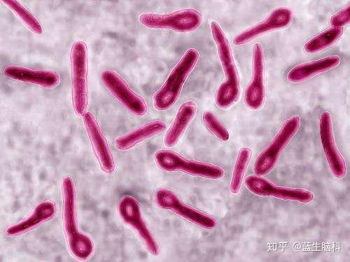 破伤风杆菌颜色图片