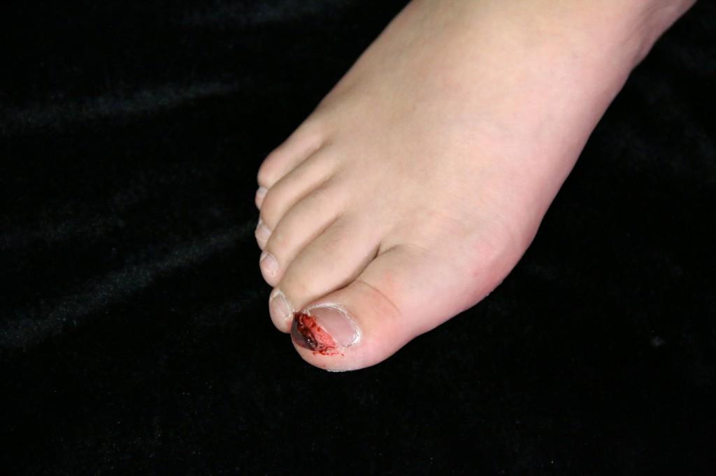 走路脚趾磕破的疼痛你可以体会吗影视中原来这样化的