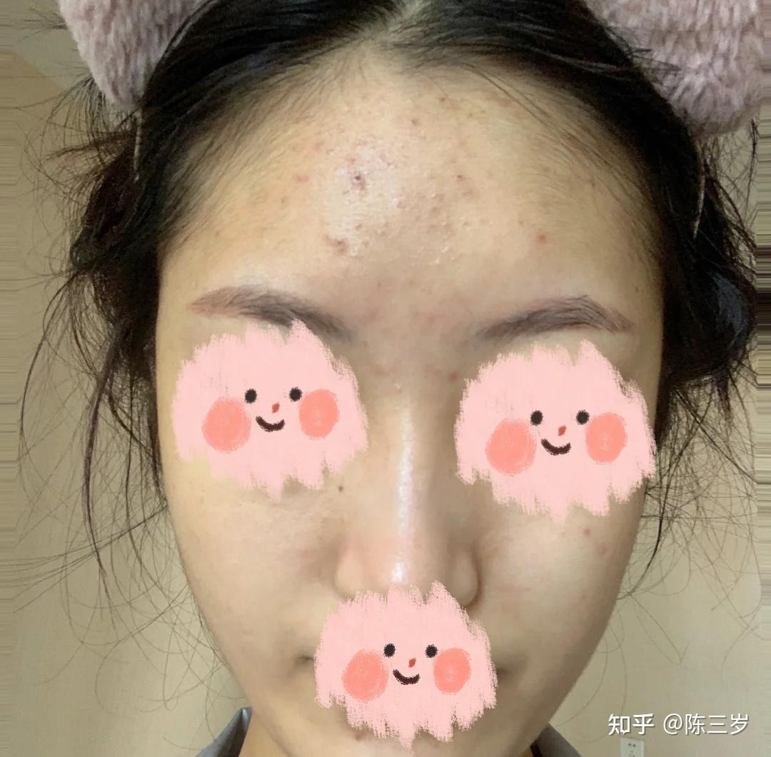 有哪些真正改变皮肤状态的护肤品