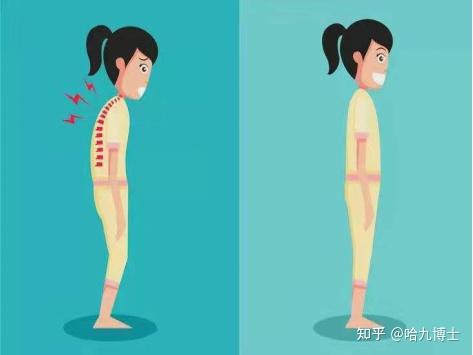 佝偻,驼背,为什么我的孩子体态看起来像个老人? - 知乎